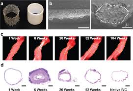 Tissue engineered vascular grafts transform into autologous neovessels  capable of native function and growth | Communications Medicine