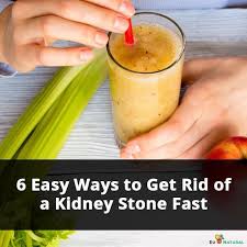 6 Easy Ways To Get Rid Of A Kidney Stone Fast Eu Natural Kidney Stones Kidney Stones Symptoms Treat Kidney Stones