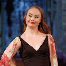Nazývá se jinak i trizomie, aneuploidie atd. Madeline Stuart Wants To Be The First Model With Down Syndrome To Walk In The Victoria S Secret Fashion Show Teen Vogue
