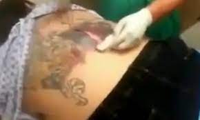 Rodney, so an otc antibiotic ointment isn't going to cut it. River Of Brown Pus Pours From Abscess Caused By Infected Tattoo In Video Daily Mail Online
