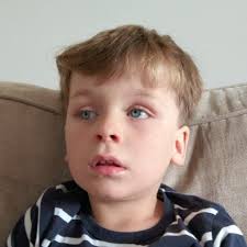 James' retinoblastoma story