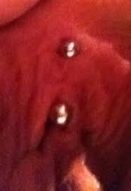 Vertical Clitoral Hood Vch Piercing Jewelry Problem