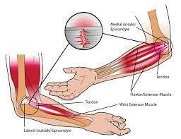 Pin On Massage