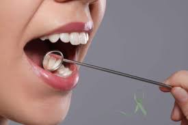 Image result for dental cancer
