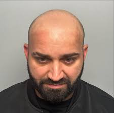 AFTER 3rd SESSION BOOK YOUR FREE CONSULTATION TODAY! 586-596-6010 #JOESMP  #SCALPMICROPIGMENTATION #CONFIDENCEBOOST#scalpmicropigmentation #smp  #scalptattoo #hairloss #microblading #hairtattoo #pmu #permanentmakeup  #micropigmentation #hairlosssolutio ...