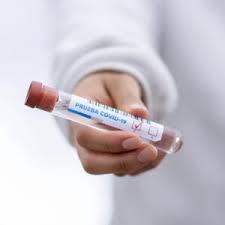 New Coronavirus Testing Services The Smart Clinics London