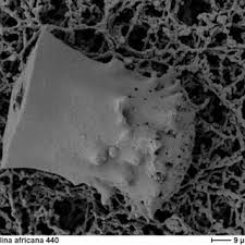 Image result for Stanfieldiella imperforata