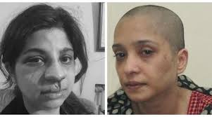 Medical reports of Lahore women Asma, Hajra reveal torture, injuries