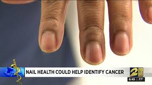 nail health could help identify cancer