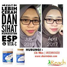Disyorkan oleh pakar kulit malaysia. Suntikan Vitamin C Yang Diluluskan Kkm