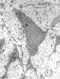 Check spelling or type a new query. Stem Cell Wikipedia