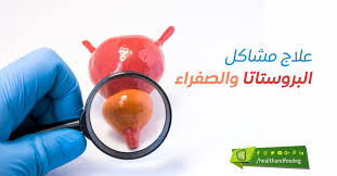 علاج مشاكل البروستاتا والصفراء Fruit Food Olive