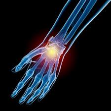Image result for Hand Injury