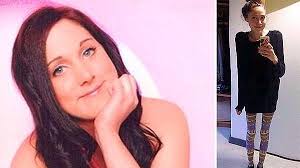 Bir Yıl Boyunca Hiçbirşey Yemedi