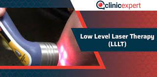 There are indications it is very helpful for tinnitus and other inner ear conditions. Low Level Laser Therapy Lllt Clinicexpert International Healthcare
