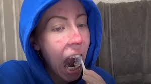 She stopped brushing her teeth for years...