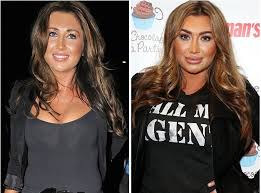 No need to call the experts for help, she has a face that reeks of plastic surgery. Lauren Goodger Lauren Goodger Fashion Women