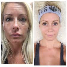 i don't use leona but what's so special about this skin