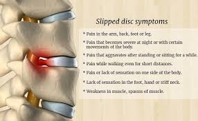 These 6 discs have chances of all types of disc problems, whatever happens in the other parts of the spine. Slipped Disc Facts Symptoms Treatments Top 10 Top Ten Gama