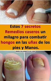 Estos 7 Secretos Remedios Caseros Un Milagro Para Combatir Hongos En Las Unas De Los Pies Y Manos Secretos Belleza Elegancia Cuerpo Eliminar Hongos De Las Unas Remedio Para Hongos Y
