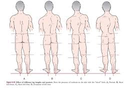 Image result for Functional Leg Length Discrepancy