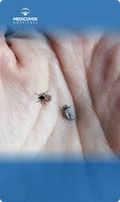 Image result for Typhus