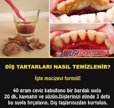 Dis Tartarlarina Ceviz Kabugu Health Health Blog Healthy Beauty