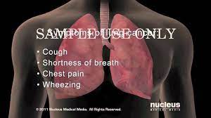 Many of the signs and symptoms can also be caused by other medical conditions but finding lung cancer early can mean that it's easier to treat. Lung Cancer Symptoms Youtube