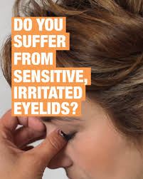 Image result for Blepharis sol