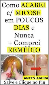 pin on vida