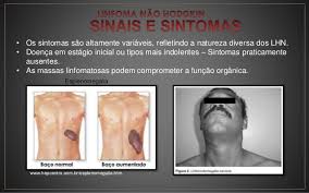 Após o diagnóstico, o linfoma é classificado de acordo com o tipo (se é linfoma não hodgkin ou linfoma de hodgkin) e o estágio em que se encontra (ou seja, sua extensão). Lnh Linfoma Nao Hodgkin