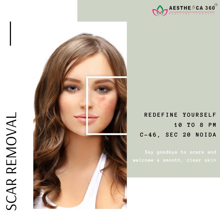 Scar Removal product image