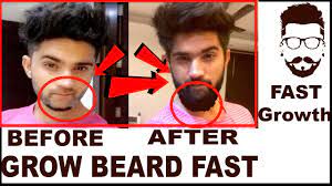 There are several steps that you can take to increase your beard quicker and easier. How To Grow Beard Fast 100 Beard Growth Tips In Hindi English India Youtube