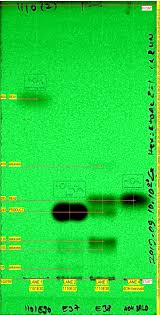 How to calculate rf values. Is There Any Tcl Manager And Tlc Rf Calculator App Which Can Calculate Rf Values From Tlc Images