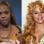 Skin Lightening Surgery Before And After Pictures Cost Procedure Skin Bleaching Lighten Skin Skin Bleaching Cream