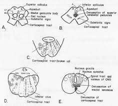 Functions of the brain stem. Bookbrain Stem Nuclei Helpful Brainstem Figures Litfl Neurology Rule Of 4 Brainstem Development Is Similar To Spinal Cord Development And Unfolds Like A Book