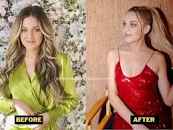 Kelsea Ballerini Weight Loss. Diet & eating Disorder Details