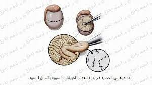 استخراج الحيوانات المنوية للحقن المجهري earbuds electronic products washer necklace