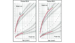 Patient Iii 4 And Iii 3 Growth Charts For Height And Weight