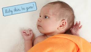 The fats in the oil sink into the skin and help stop the skin from drying out and getting more irritated. My Itchy Baby How To Diagnose And Treat Baby Eczema Sassy Mama