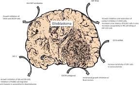 Blood from the kidney the pituitary gland, also known as the hypophysis, is connected to the hypothalamus of the brain by a it causes the kidney to secrete more water, so blood pressure can decrease. Pathogenic Role For Macrophage Migration Inhibitory Factor In Glioblastoma And Its Targeting With Specific Inhibitors As Novel Tailored Therapeutic Approach Abstract Europe Pmc