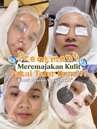 Rekomendasi Klinik Kecantikan Terbaik di Surabaya