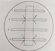 What does schick test mean? Elek Test Principle Procedure Results Microbe Online