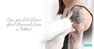 With advances in technology, lasers are the best option for tattoo removal. Can You Get Laser Hair Removal Over A Tattoo