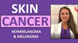 Learn more about targeted therapy, surgery, and chemotherapy. Skin Cancer Basal Squamous Cell Carcinoma Melanoma Actinic Keratosis Nursing Nclex Youtube