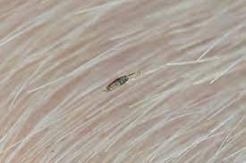 Synthetic fibers can be knit and woven similarly to natural fibers. Head Lice And Nits Nhs