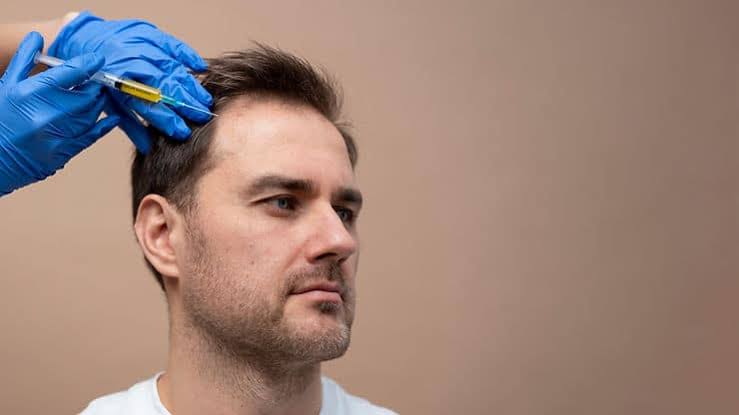 Why Does A Hair Transplant Appear Natural Years After The Procedure?