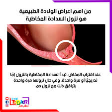 بولادتي بابني نزلت مني السدادة واشربت. Iraqi Toddler Ø³Ø§Ù…Ø¹ÙŠÙ† Ù‚Ø¨Ù„ Ø¨Ø§Ù„Ø³Ø¯Ø§Ø¯Ù‡ Ø§Ù„Ù…Ø®Ø§Ø·ÙŠÙ‡ Ù…Ø¹Ù„ÙˆÙ…ØªÙ†Ø§ Facebook