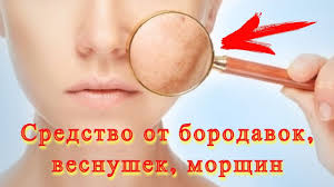 как избавиться от бородавок под мышками в домашних условиях Kak Izbavitsya Ot Borodavok Morshin Vesnushek S Pomoshyu Narodnogo Sredstva In 2020 Food