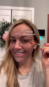 HOW MANY UNITS OF TOX DO I NEED?, While everyone is different and the  required amount varies with each person. Here is a typical average dose  needed per treatment area. Keeping in mind that dose ...